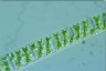 Spirogyra