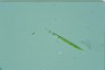 Euglena acus