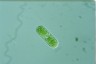 Cylindrocystis