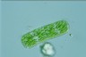 Cylindrocystis