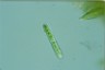 Cylindrocystis