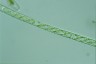 Spirogyra