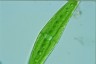 Closterium moniliferum