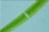 Closterium acerosum