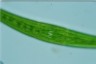 Closterium costatum