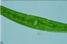 Closterium costatum