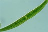 Closterium costatum