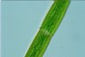 Closterium costatum