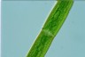 Closterium costatum