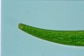 Closterium costatum