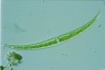 Closterium dianae