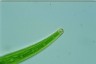 Closterium intermedium