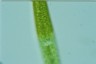 Closterium ralfsii