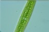 Closterium ralfsii