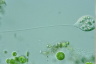 Vorticella