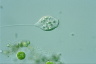 Vorticella