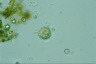 Choanocystis aculeata