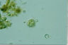 Choanocystis aculeata