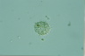 Choanocystis aculeata