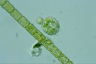 Choanocystis aculeata