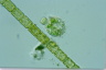 Choanocystis aculeata