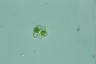 Staurastrum alternans