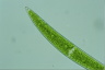 Closterium acerosum