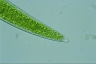 Closterium acerosum