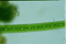 Closterium acerosum