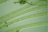 Spirogyra