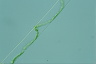 Spirogyra