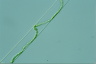 Spirogyra