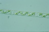 Spirogyra