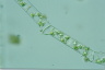 Spirogyra