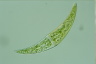 Closterium moniliferum