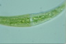 Closterium moniliferum