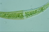 Closterium moniliferum