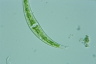 Closterium leibleinii