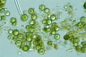 Botryococcus sudetica