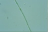 Anabaena