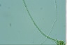 Anabaena