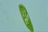 Euglena spirogyra