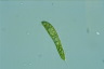 Euglena spirogyra