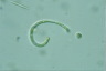 Ophiocytium parvulum