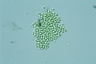 Microcystis