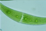 Closterium moniliferum