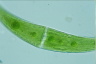 Closterium moniliferum