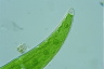 Closterium moniliferum