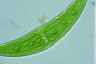 Closterium moniliferum