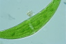 Closterium moniliferum